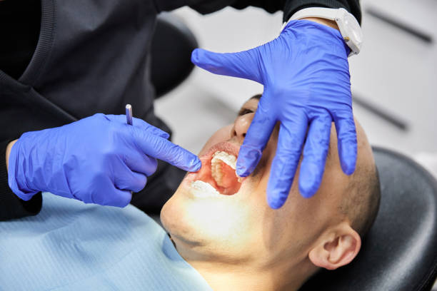 Best Emergency Dentist for Knocked-Out Tooth in Rockwood, VA